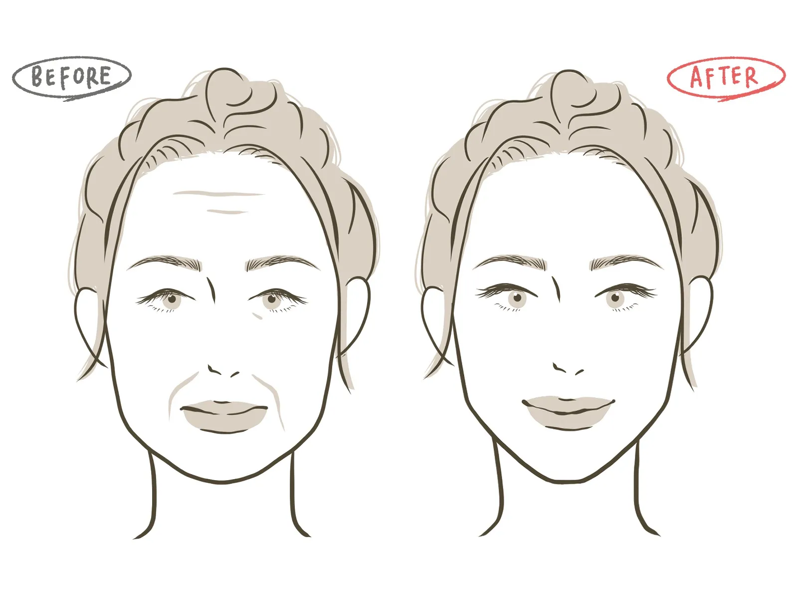 かおたるみ原因は老化？それとも⁉︎エステで解消する方法